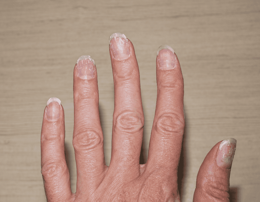 what are the symptoms of menopause